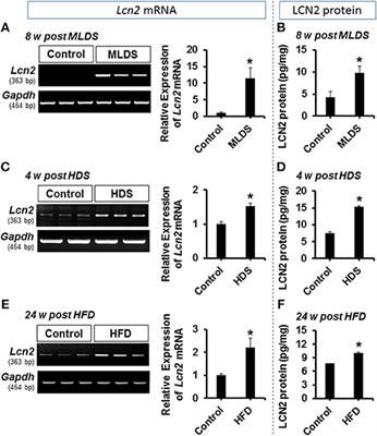 Role of Hippocampal Lipocalin-2 in Experimental Diabetic Encephalopathy